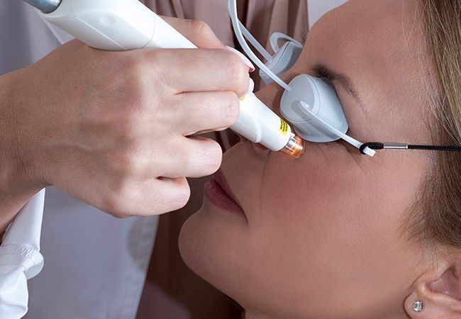 Dry Eye Treatment Procedure