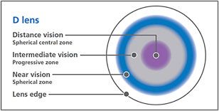 refractive