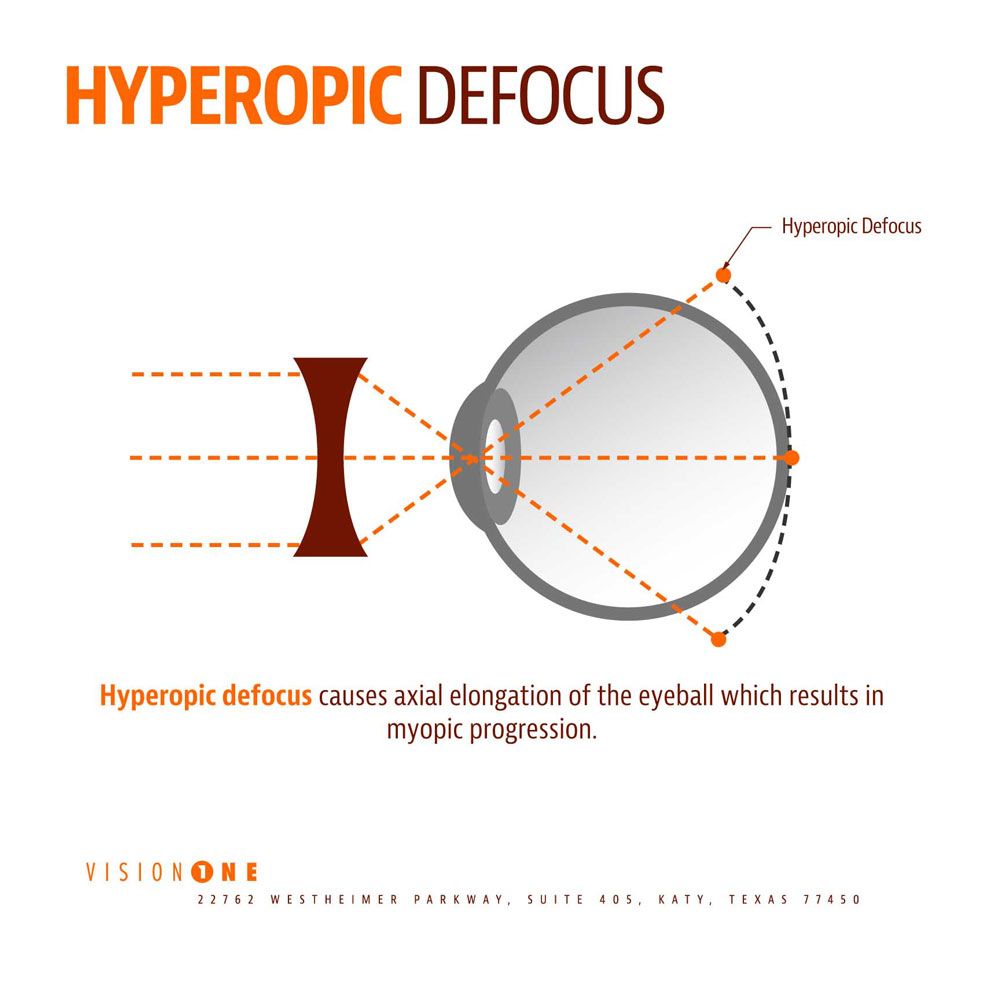 Myopia Control