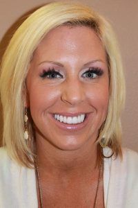Cosmetic dentistry before-and-after smile results in Spring, TX at America&rsquo;s Family Dental 16