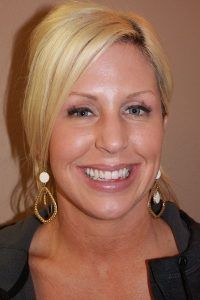 Cosmetic dentistry before-and-after smile results in Spring, TX at America&rsquo;s Family Dental 16