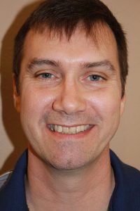 Cosmetic dentistry before-and-after smile results in Spring, TX at America&rsquo;s Family Dental 6