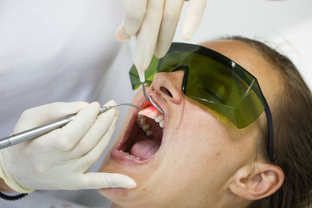 The Benefits of Laser Dentistry