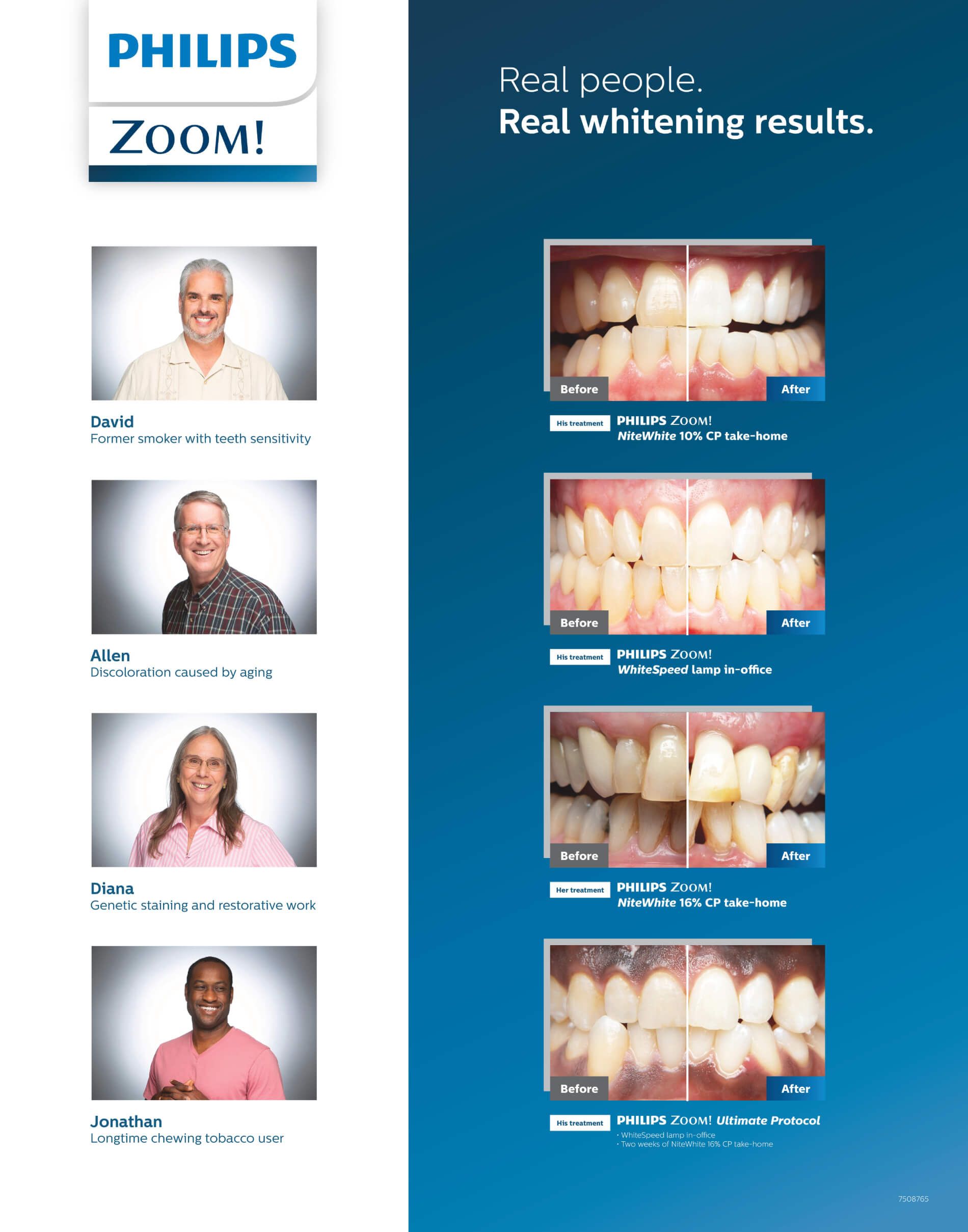 Teeth Whitening Patient Profile