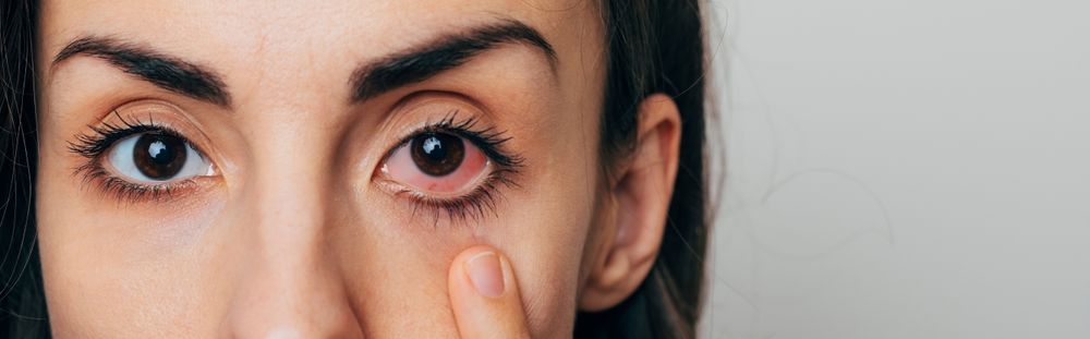 Eye Infections: Identifying Bacterial, Viral, and Fungal Causes and How to Treat Them