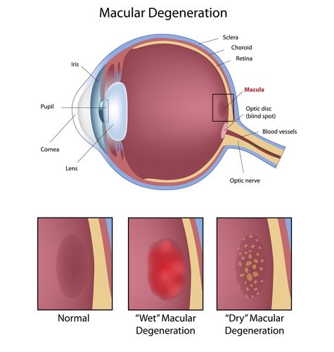 Macular