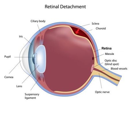 Retinal