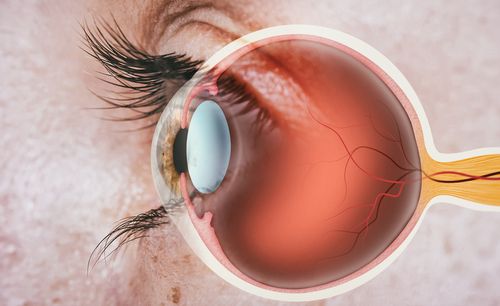 Can Diabetic Retinopathy Be Corrected?