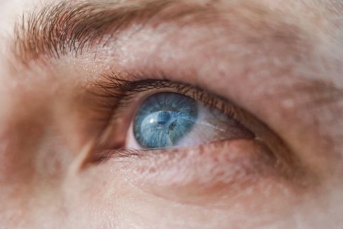 Is LASIK Surgery a Permanent Procedure?