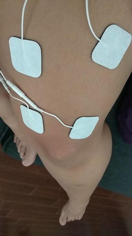 Electrical Stimulation