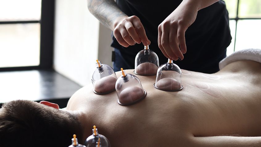 Cupping