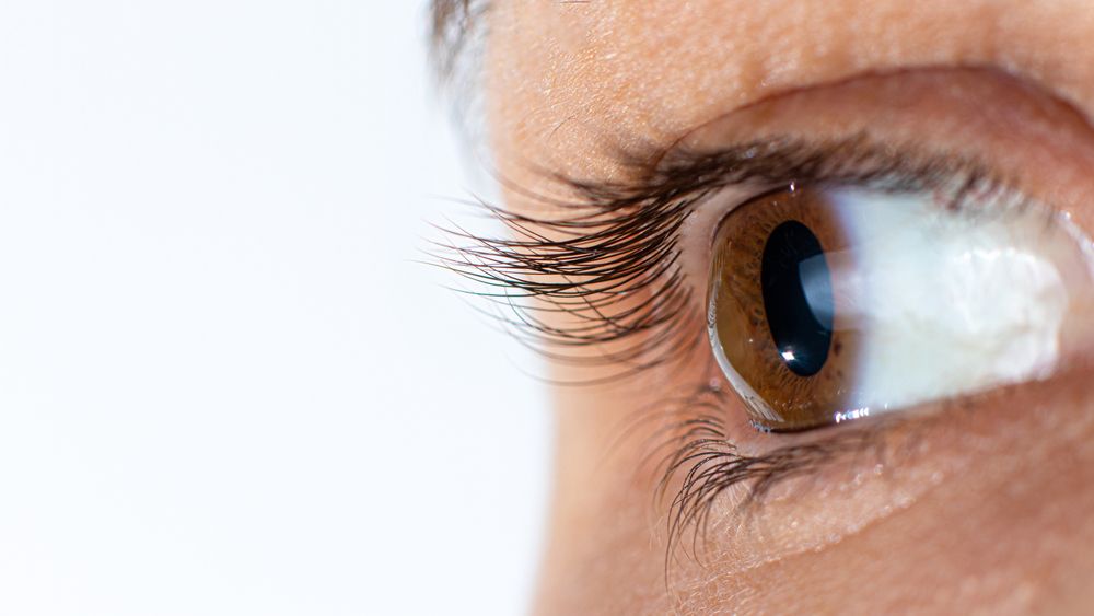 How Specialty Contact Lenses Can Help Manage Keratoconus