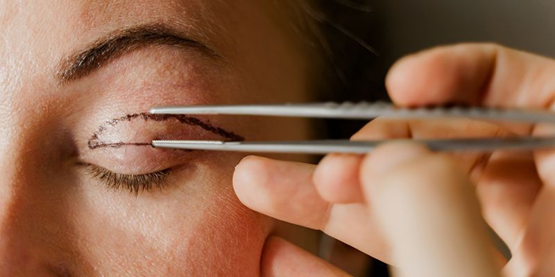 Eyelid Rejuvenation Surgery