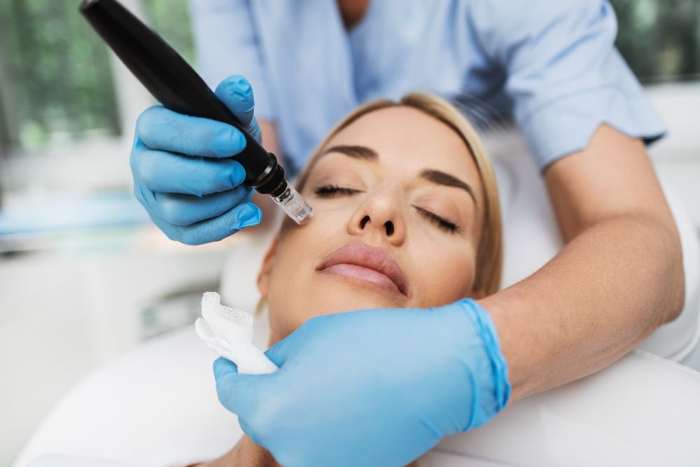 microneedling