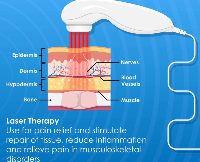 cold laser therapy