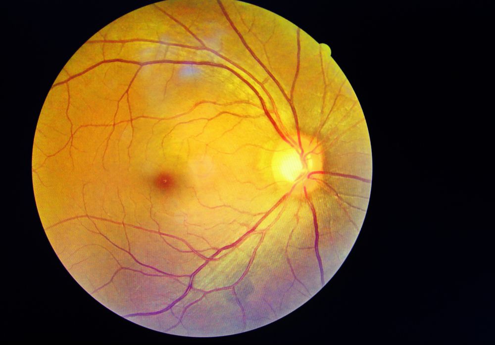 Ask Your Eye Doctor for Optomap Retinal Imaging: Here's Why