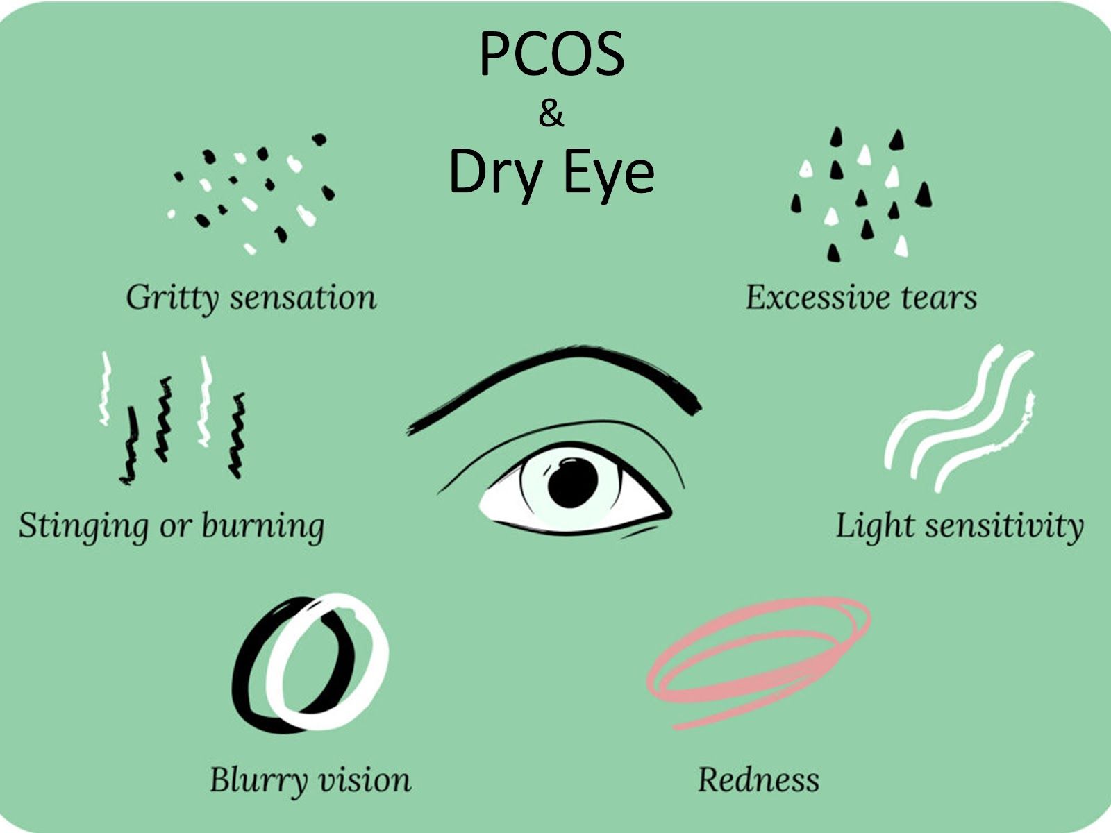 Dry Eyes are More Common in Polycystic Ovary Syndrome (PCOS) 