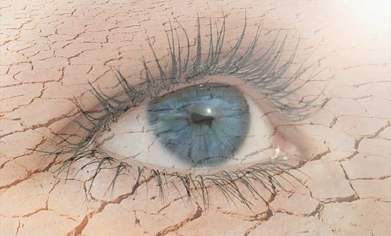 How Radiofrequency (RF) Energy Can Alleviate Dry Eye Discomfort