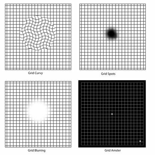 macular degeneration test