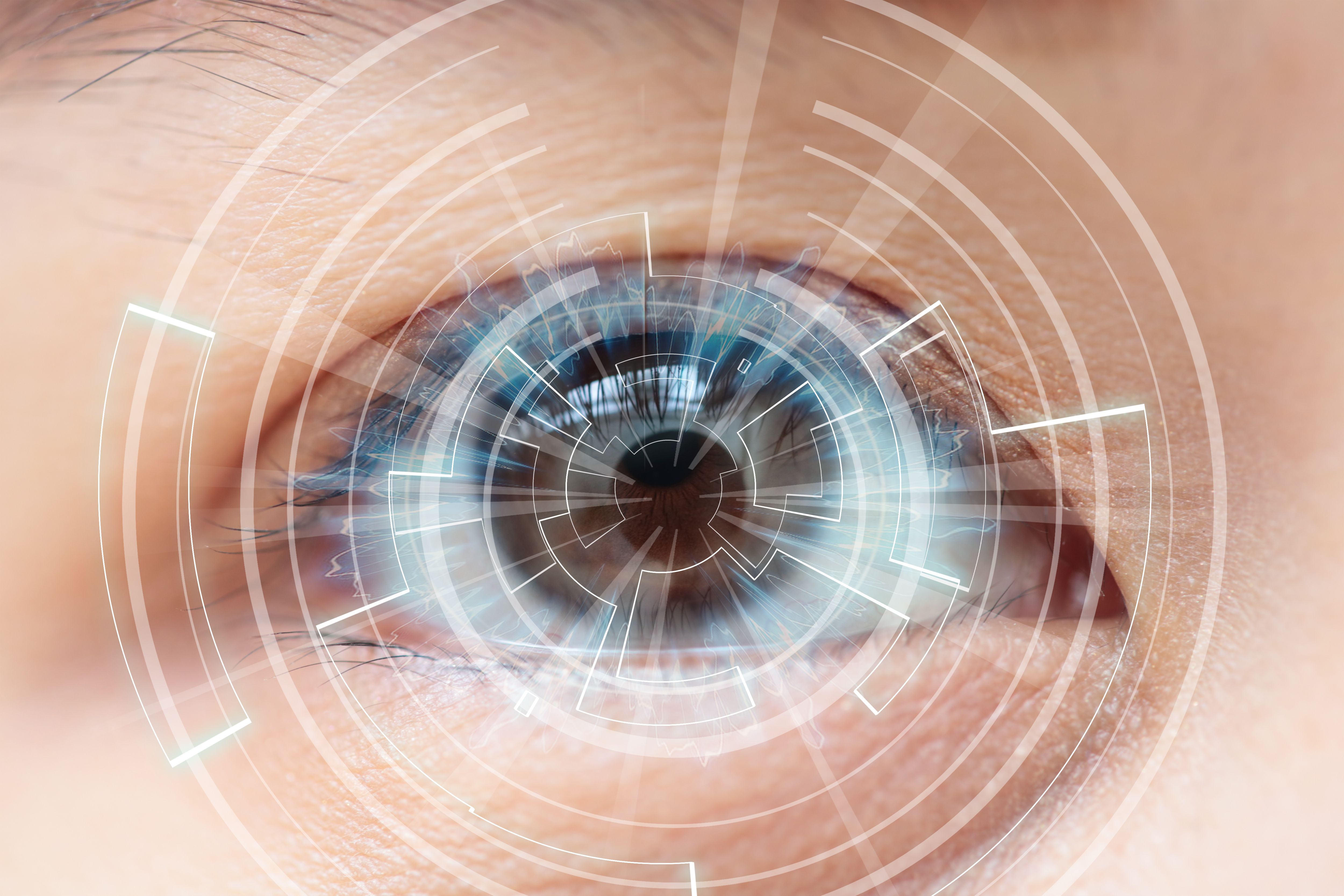 cataract eye surgery