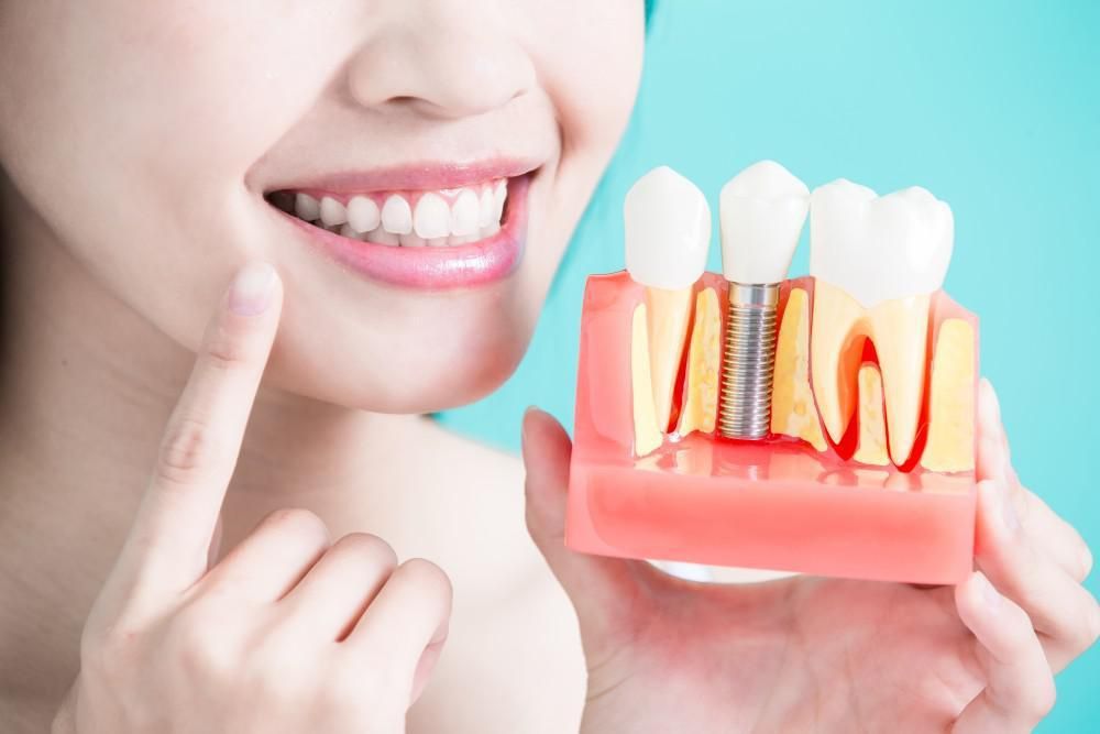  Why Dental Implants are the Best Option for Replacing Missing Teeth