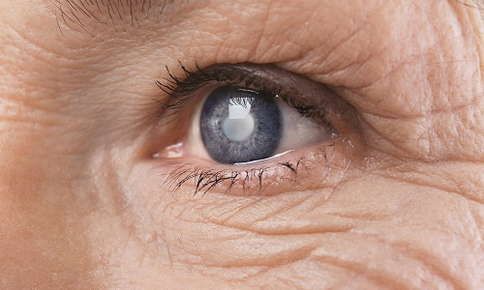 HOW TO LESSEN THE RISK OF GLAUCOMA