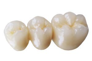 FULL CONTOURED ZIRCONIA