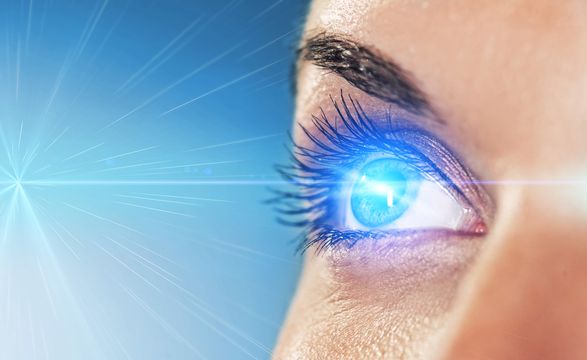 LASIK