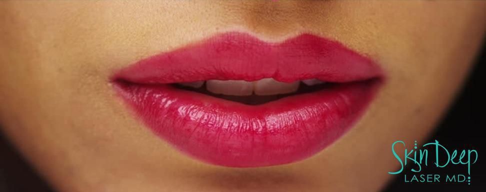 The Top 10 Things You Want to Know About Lip Filler