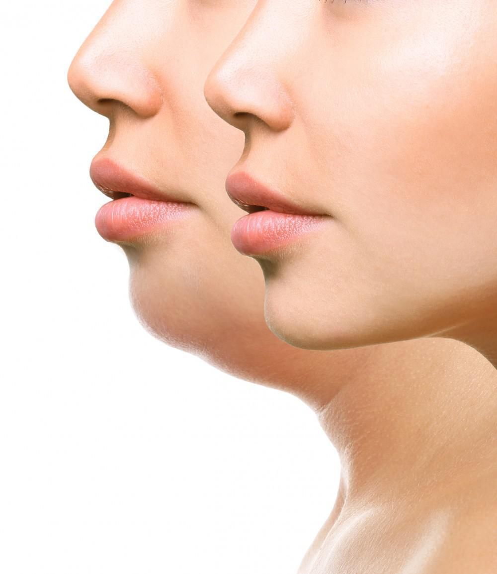 How to Reduce Double Chin Fat