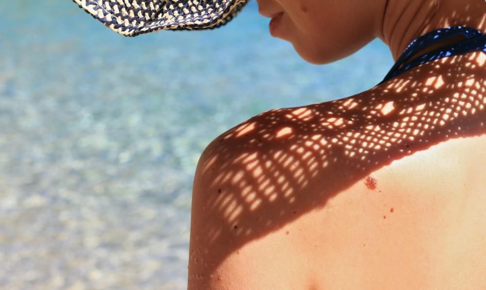 Tips for Preventing Age Spots This Summer