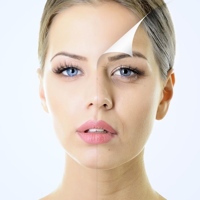 What Are Chemical Peels?