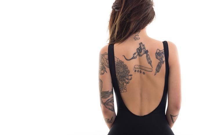 What You Need to Know About Tattoo Removal