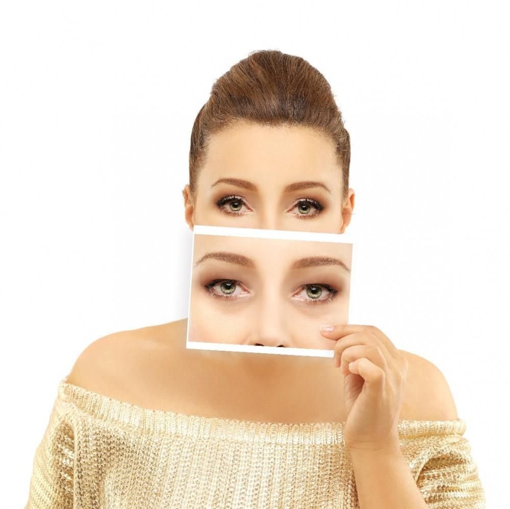 All About UPNEEQ®: The New Eyedrop for Droopy Eyelids