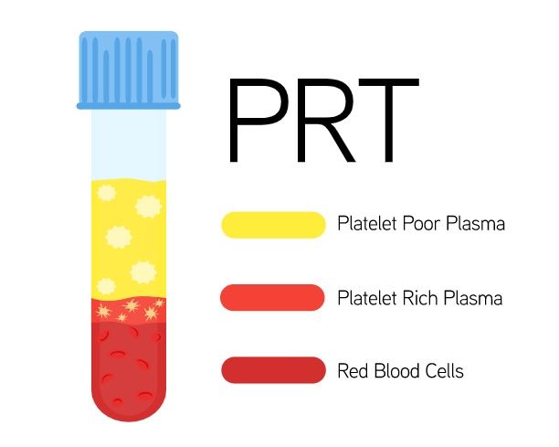 PRT