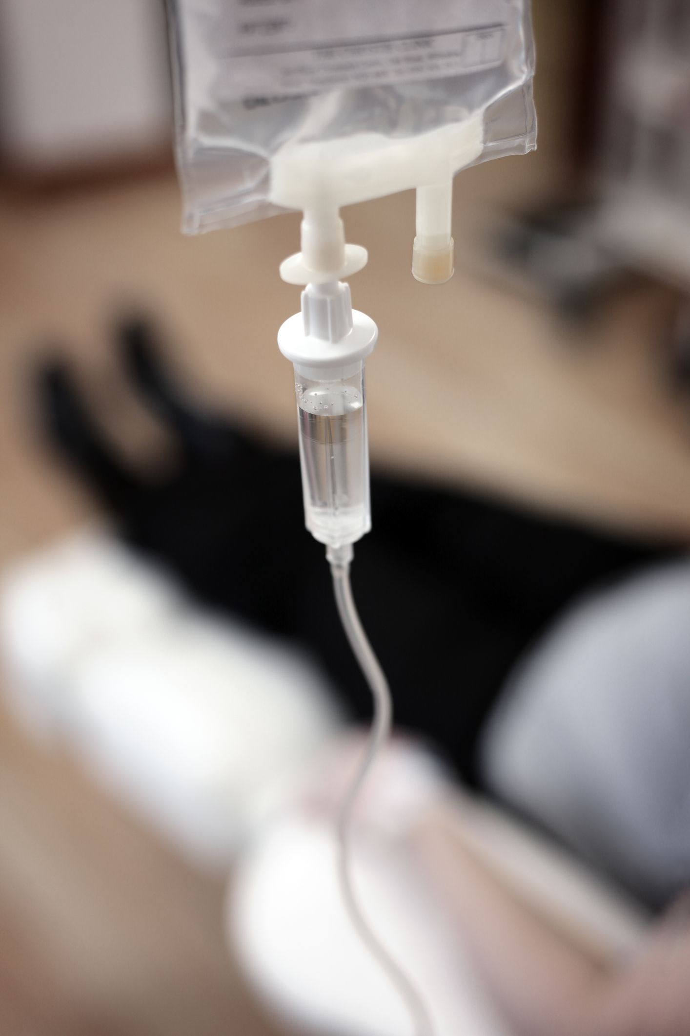 IV sedation