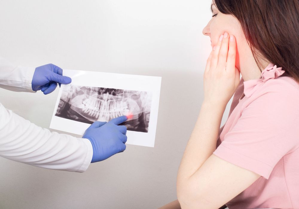 The Benefits of Wisdom Tooth Extraction