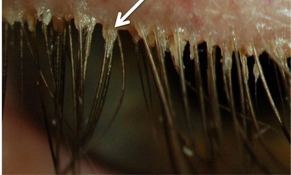 Nulids in Chowchilla at Total Vision Care Optometry