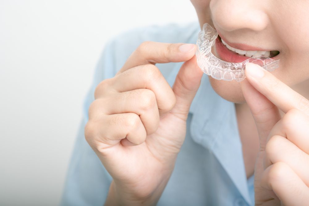 Straighten While You Sleep: How Invisalign's Removable Aligners Work Around the Clock