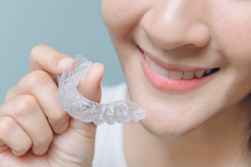 Frequently Asked Questions About Clear Aligners