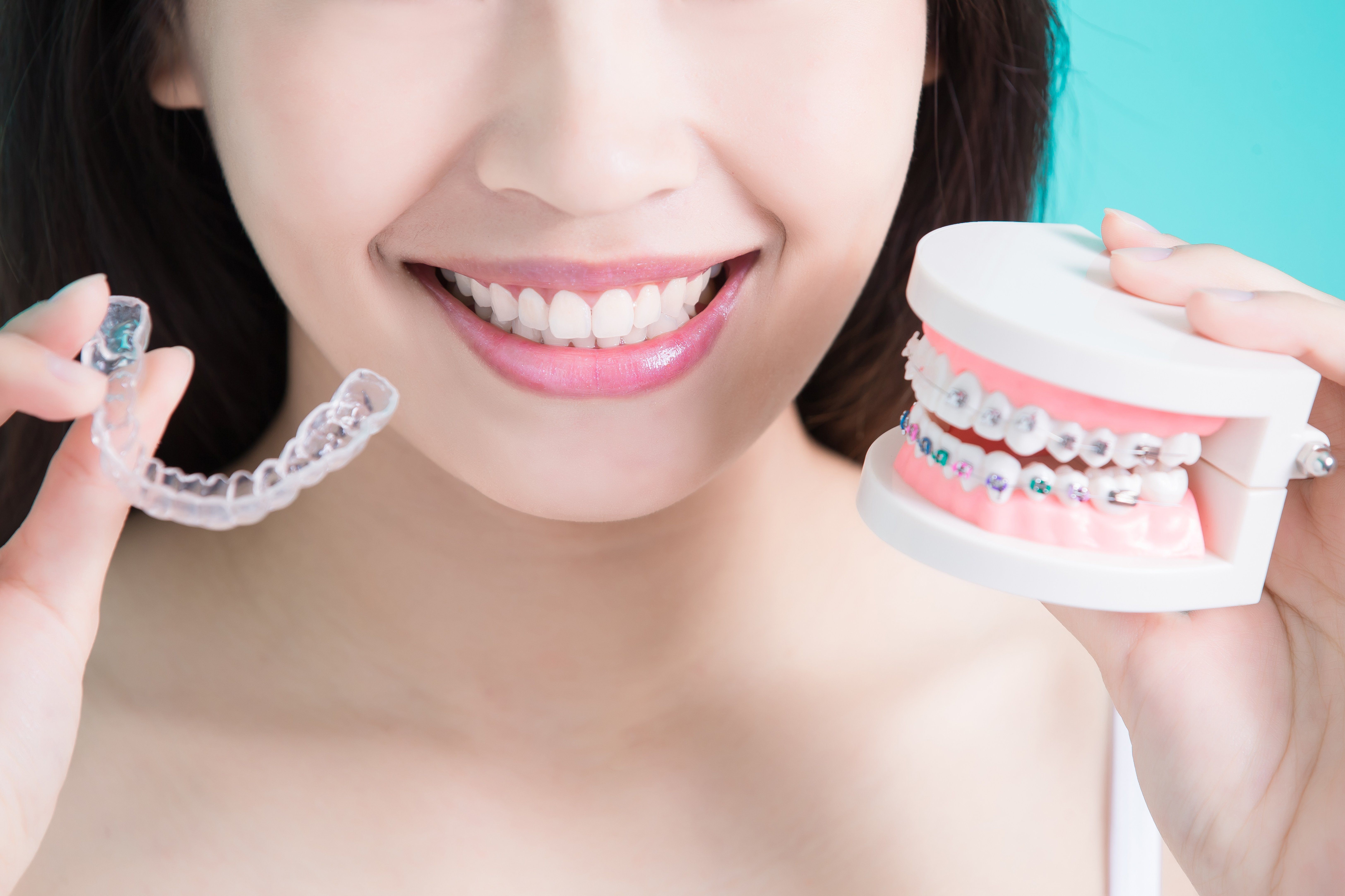 Invisalign Cost Vs. Braces Cost