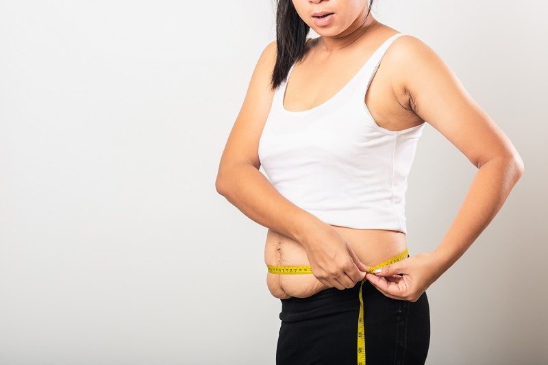 Can I Have Lap Band Weight Loss Surgery After Gastric Bypass?