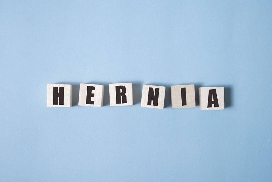 Do’s & Don'ts After Umbilical Hernia Surgery
