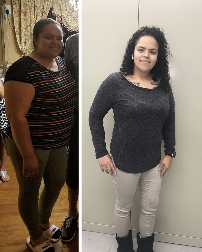 Face Before and After Photo