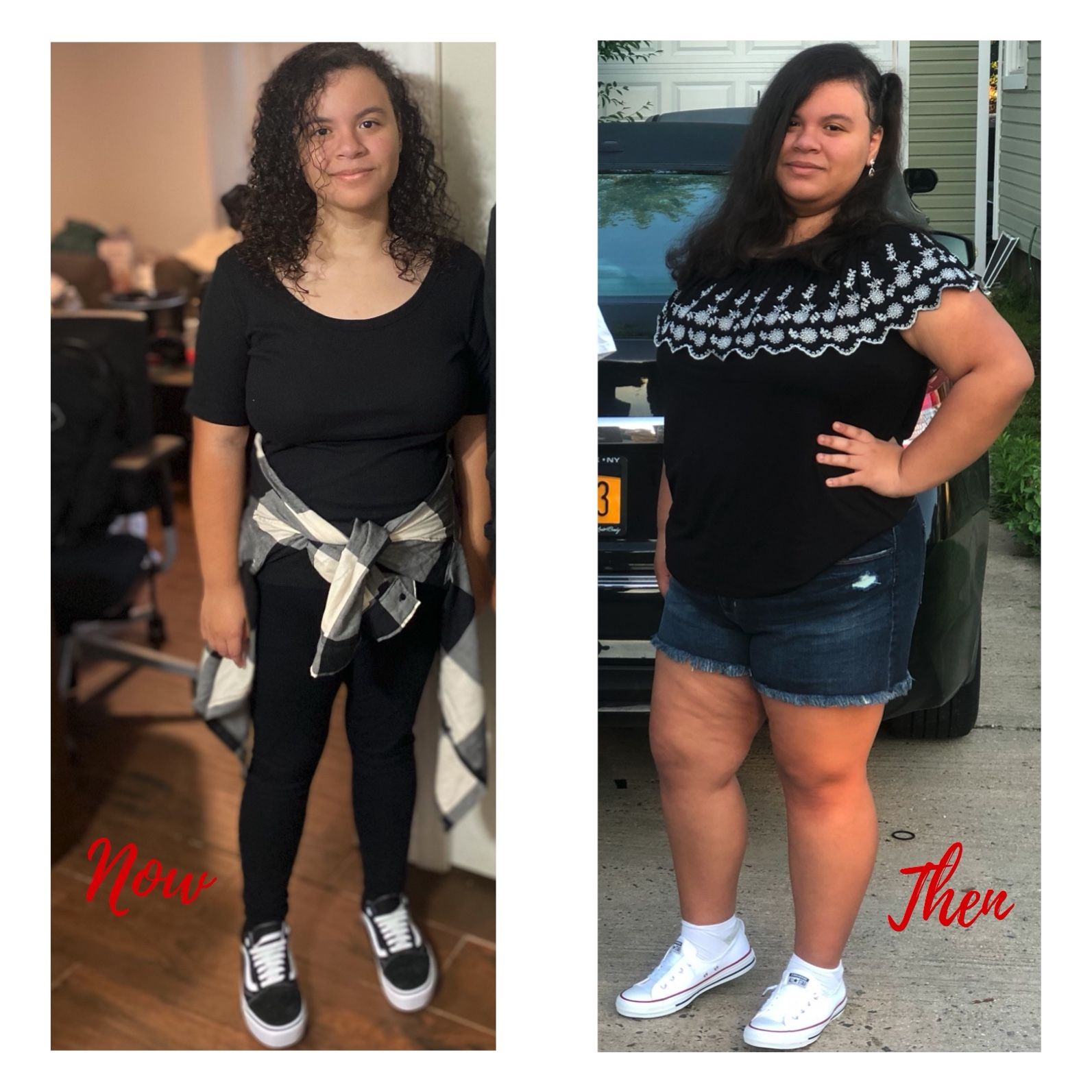 Face Before and After Photo