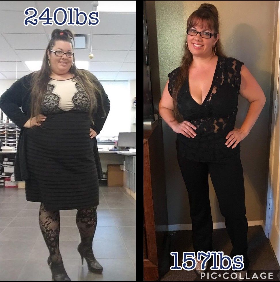 Face Before and After Photo