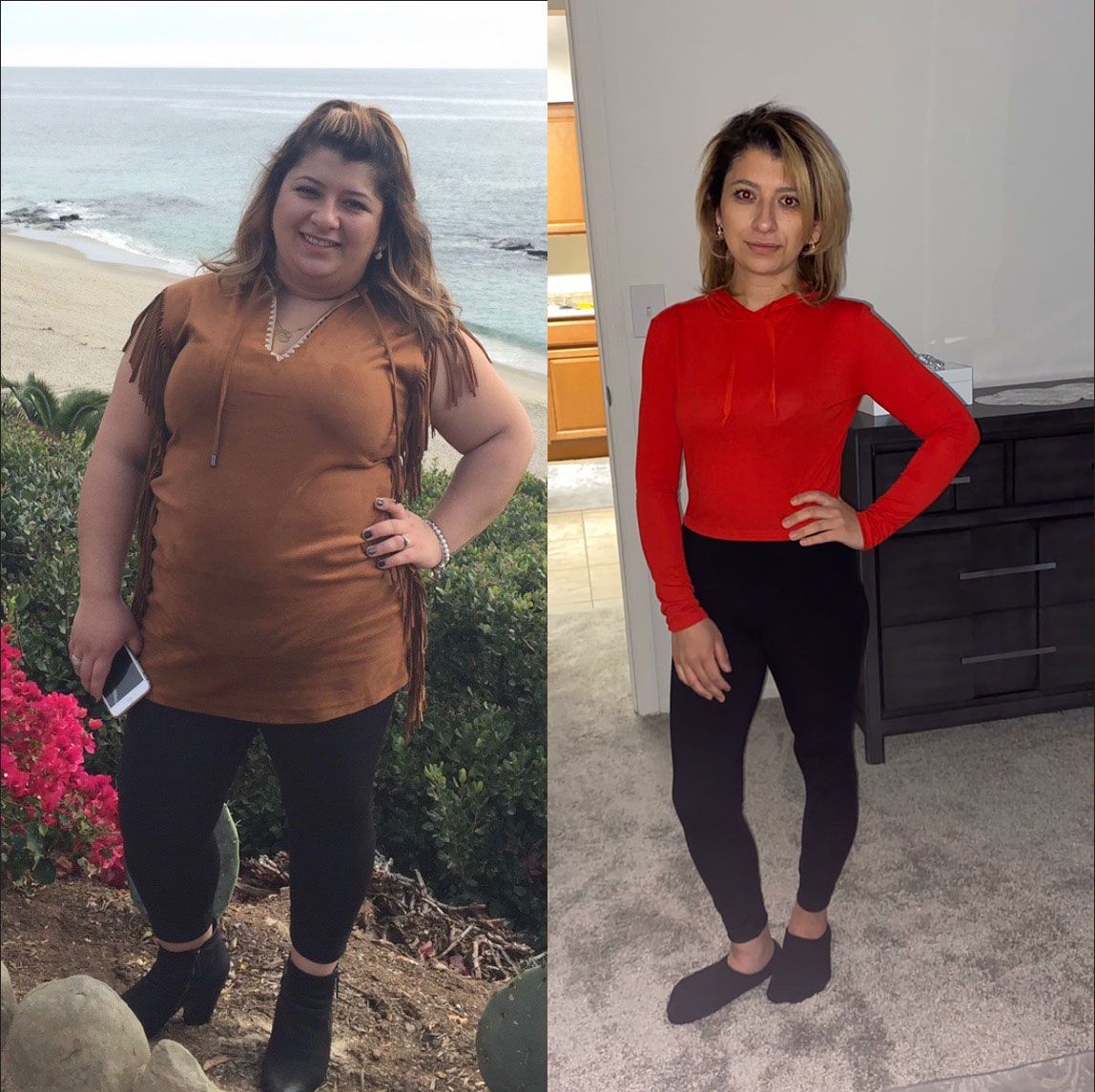 Face Before and After Photo