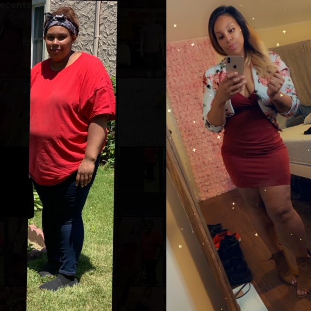 Face Before and After Photo