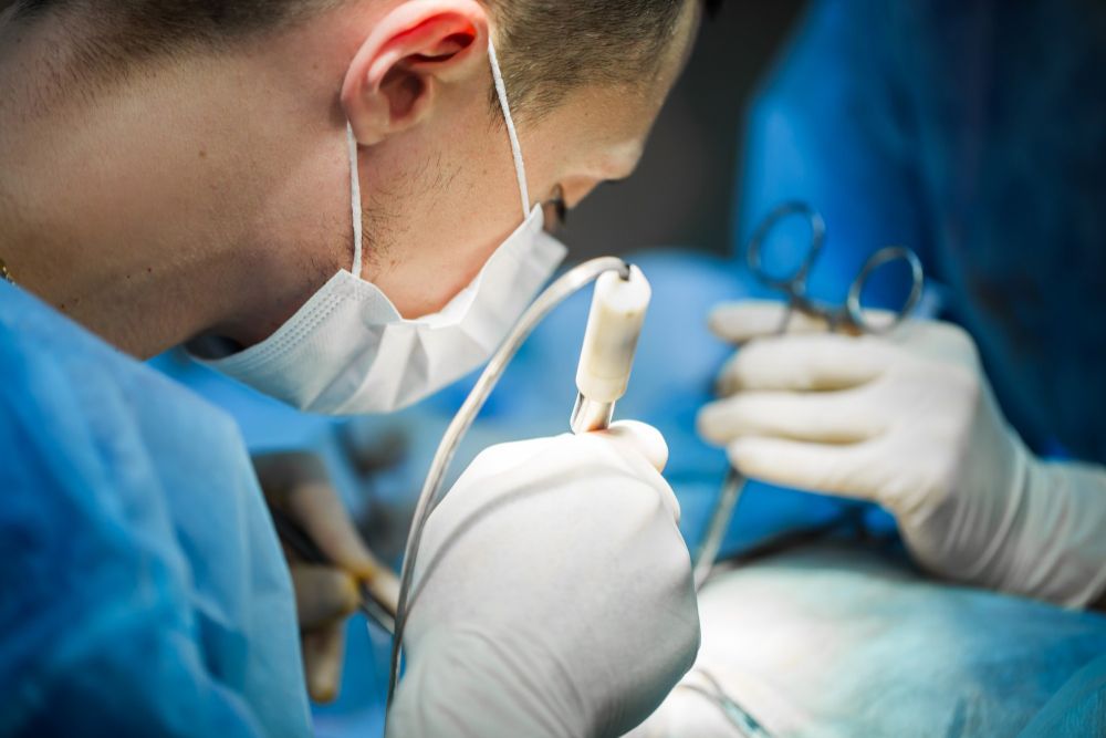 How Lipoma Removal Surgery Is Done