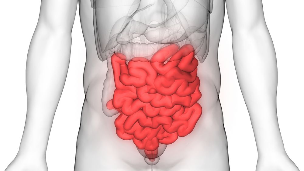 Small Intestinal Mass removal